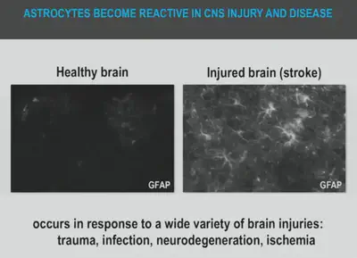 **Figure 2:** Reactive Astrocytes. Source: Ben Barres, Stanford lecture.