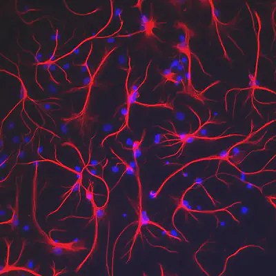 **Figure 1:** Stained Astrocytes. Notice their star shaped structure.