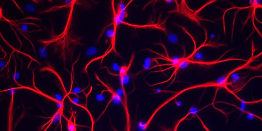 Hero or Villain: Unravelling the functions of Astrocytes